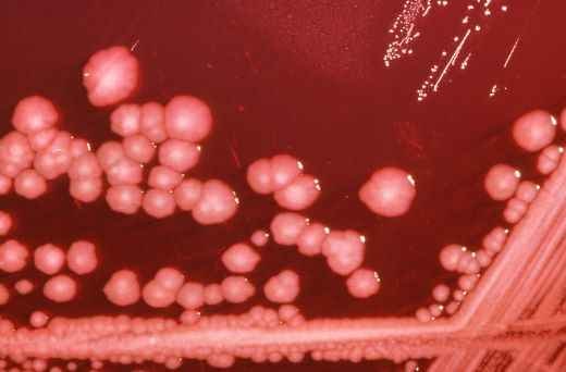 Enterobacteriaceae