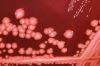 Enterobacteriaceae