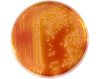 Serratia