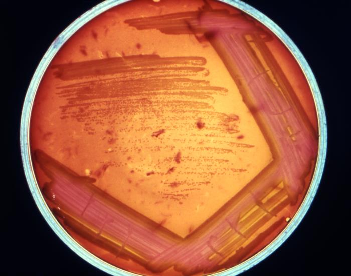 Stenotrophomonas maltophilia