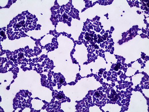 S. epidermidis