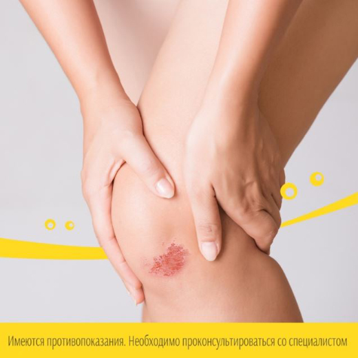 Травма колена