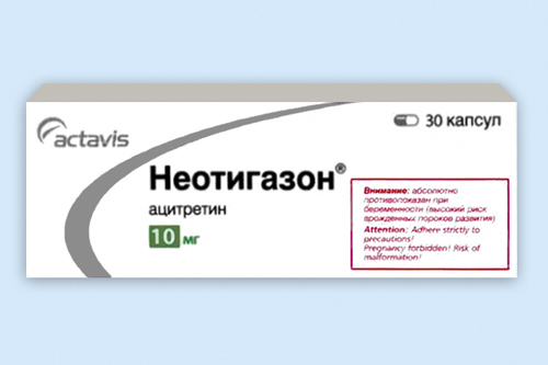 Неотигазон
